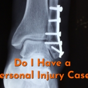 Broken bone set with screws due to a personal injury case.